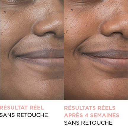 résultat réel sans retouche - résultats réels après 4 semaines sans retouche