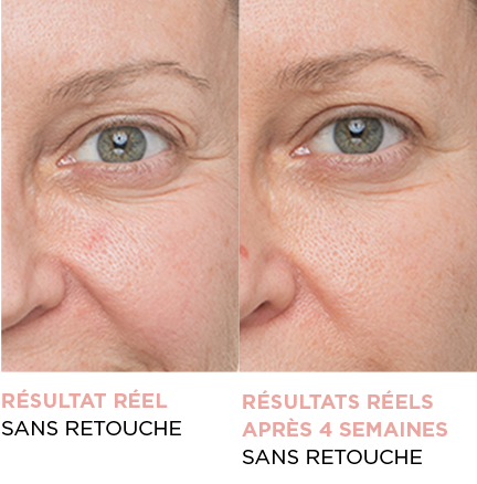 résultat réel sans retouche - résultats réels après 4 semaines sans retouche