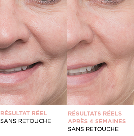 résultat réel sans retouche - résultats réels après 4 semaines sans retouche